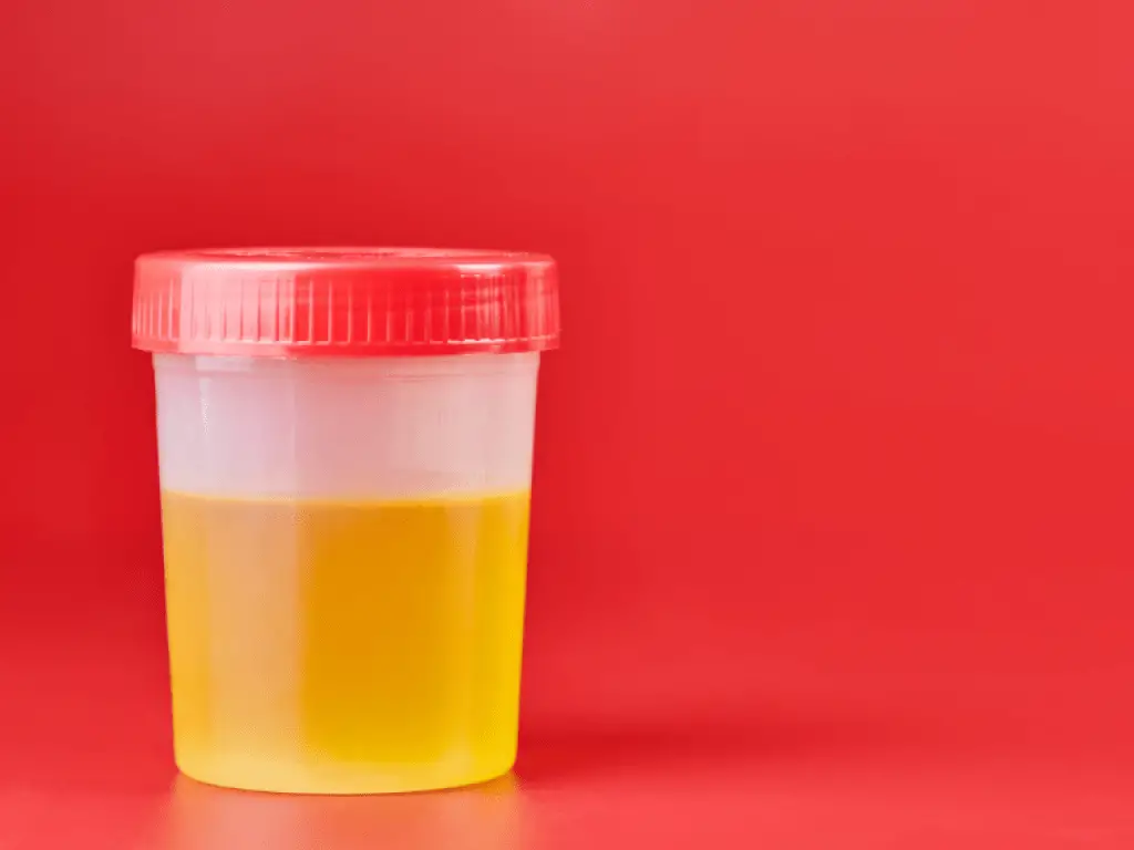 التهاب بولي